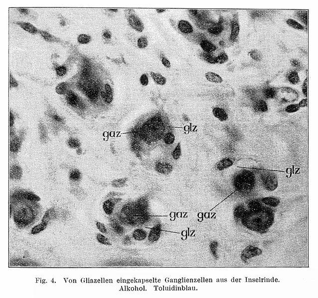 C._von_Hosslin_&_A._Alzheimer,_Ein_Beitrag_zur_Klinik..._Wellcome_L0020584.jpg