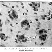 C._von_Hosslin_&_A._Alzheimer,_Ein_Beitrag_zur_Klinik..._Wellcome_L0020584.jpg